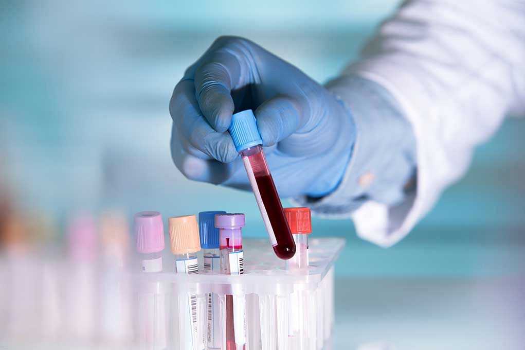 441264445 Gloved hand holding a blood sample test tube